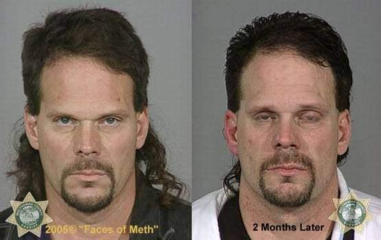 Faces-of-Meth-Before-and-After-Death_18