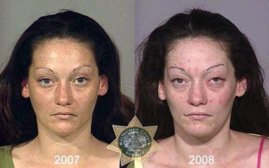 Faces-of-Meth-Before-and-After-Death_19