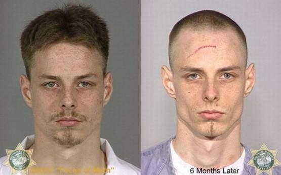 Faces-of-Meth-Before-and-After-Death_22