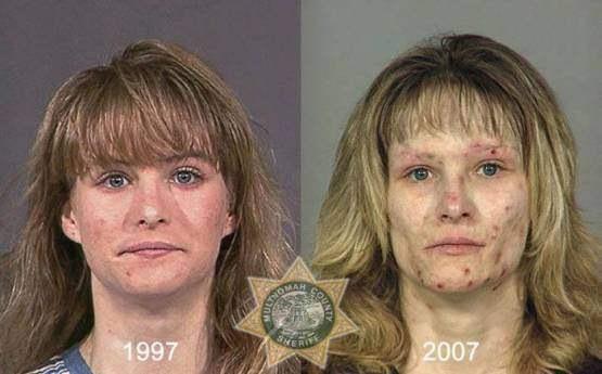 Faces-of-Meth-Before-and-After-Death_31