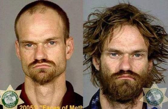 Faces-of-Meth-Before-and-After-Death_33