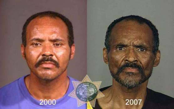 Faces-of-Meth-Before-and-After-Death_42