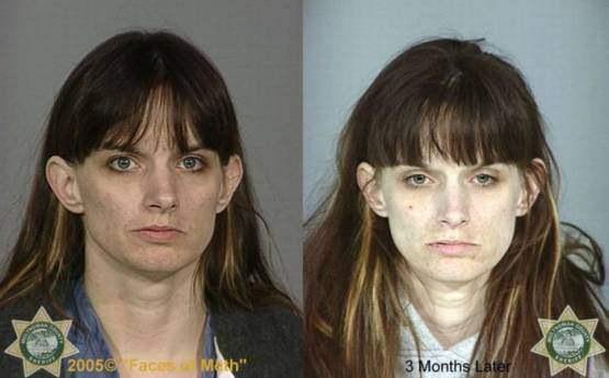 Faces-of-Meth-Before-and-After-Death_43