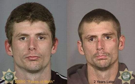 Faces-of-Meth-Before-and-After-Death_55