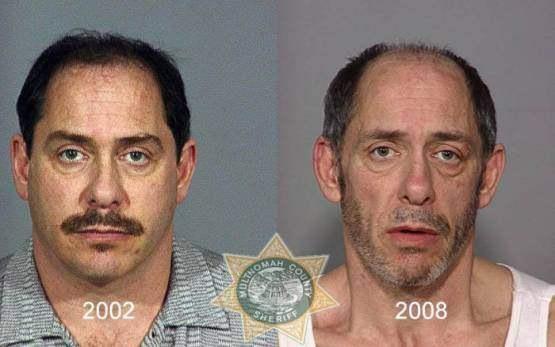 Faces-of-Meth-Before-and-After-Death_59
