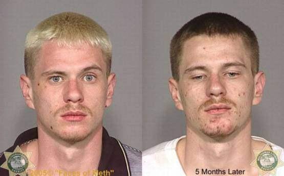 Faces-of-Meth-Before-and-After-Death_8